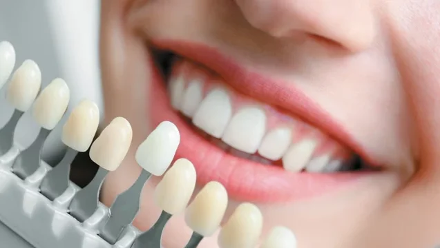 Cosmetic Dentistry